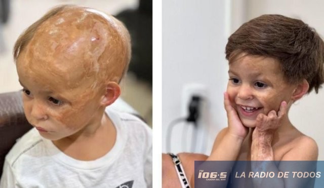 lorenzo2