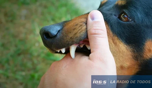 Mordedura perro
