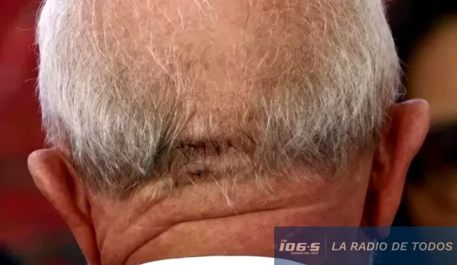 Lula-caída