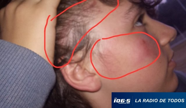 niñó agredido