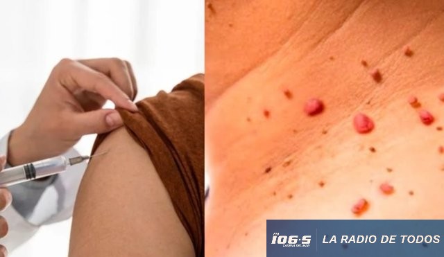 VPH: un desafío sanitario que ignora las barreras de género.