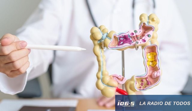 cancer de colon