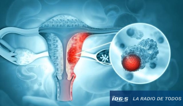 oncologia