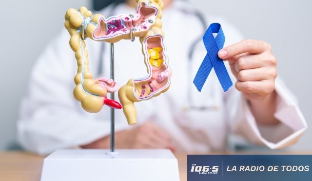 Punta del Este: instalarán un colon gigante interactivo para concientizar sobre el cáncer colorrectal.