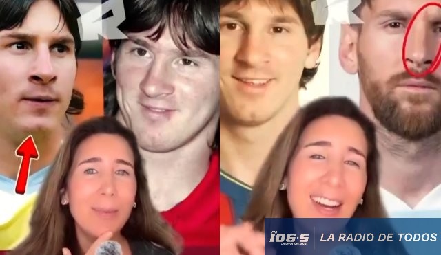 messi cirugía