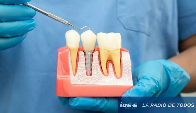 DIENTES TECNOLOGICOS