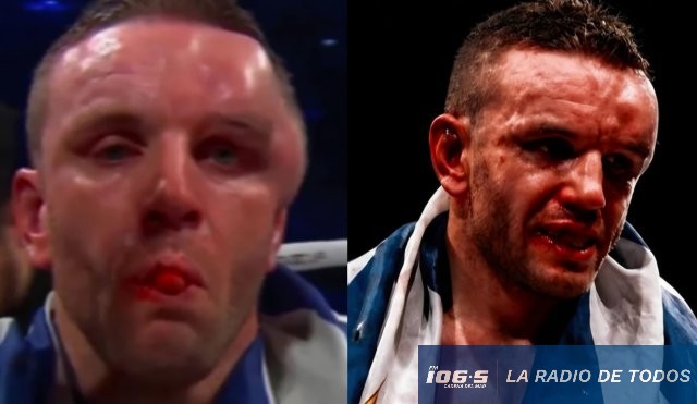 Duelo BKFC (Antel Arena): rostro de Emiliano Nielli quedó desfigurado.