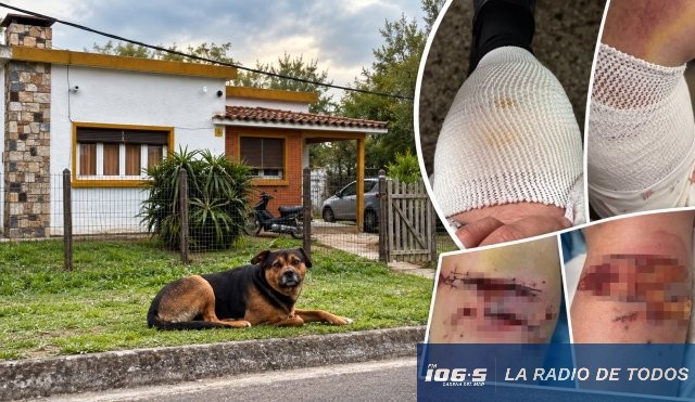 Pan de Azúcar mujer atacada por perro 