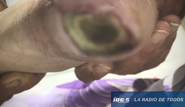 “Descuidaron muchísimo a mi abuela y ahora evalúan amputarle un pie”.