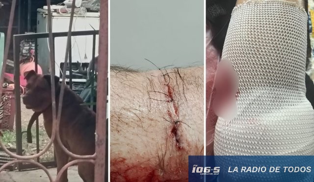 Ataque de perro san carlos